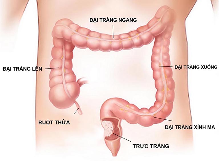Đại Tràng Là Gì? Hình Ảnh, Vị Trí, Chức Năng Của Đại Tràng