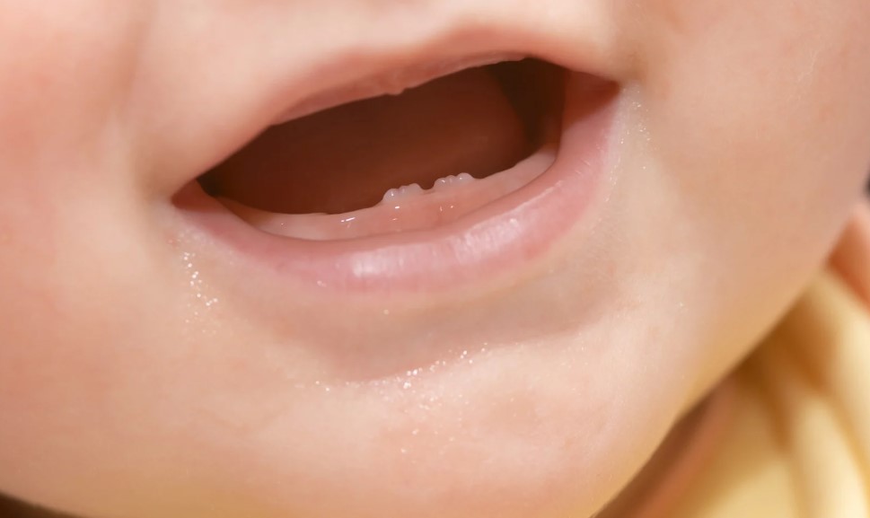 Trẻ mọc răng chậm do đâu, có sao không?