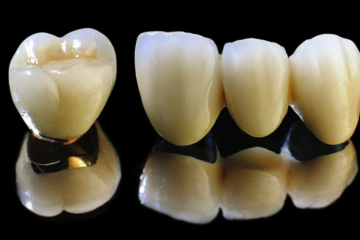 Bọc răng sứ Titan – Những điều cần biết.